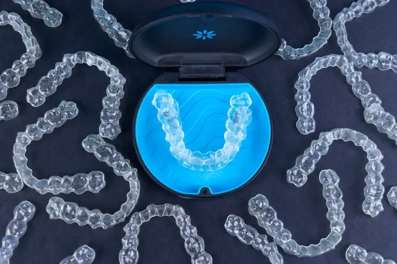 Ile kosztują nakładki Invisalign?