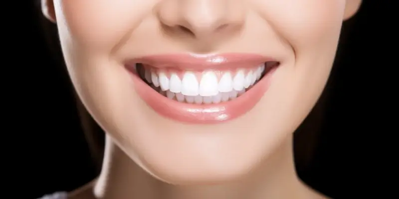 Licówki czy korony co lepsze?