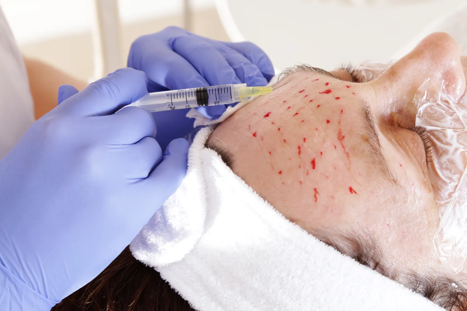 Medycyna estetyczna jakie studia?