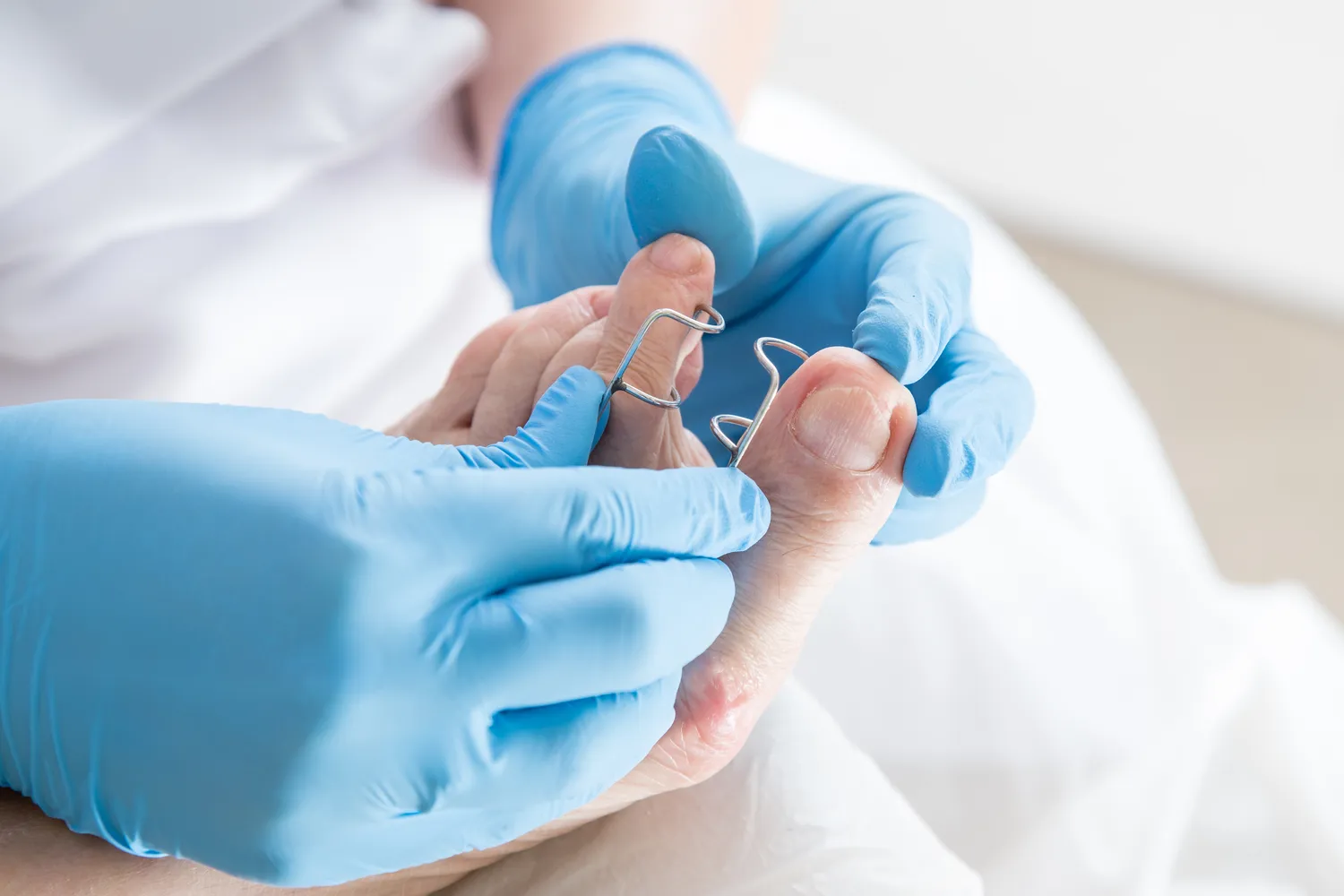 Podolog radzi - jak przygotować stopy na wiosnę